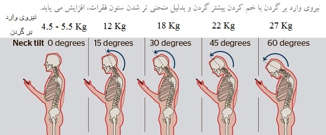 نتیجه تصویری برای گردن درد پیامکی