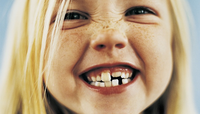 دلیل و درمان دندان قروچه