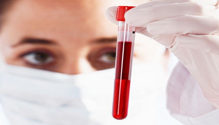 10 نکته آزمایش خون که پزشک هرگز به شما نخواهد گفت!