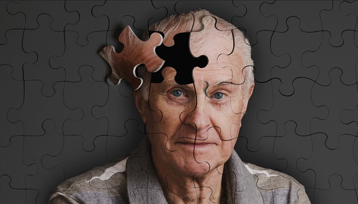 10 حقیقت مهم درباره بیماری آلزایمر