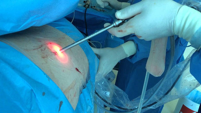 روش های توانبخشی و غیرجراحی جایگزین مناسب جراحی دیسک کمر