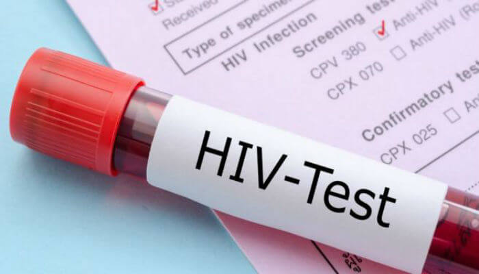 من هم آزمایش اچ آی وی می دهم