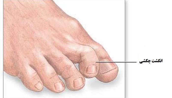 حرکات ورزشی برای تقویت انگشتان پا