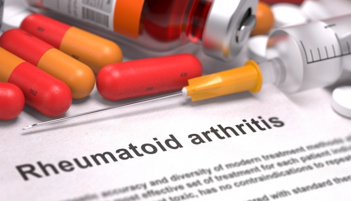نتیجه تصویری برای داروهای ضد التهاب برای آرتریت