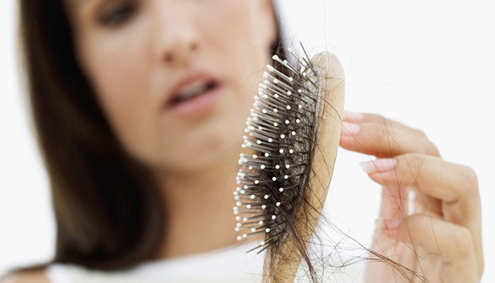 10 علل شایع ریزش مو