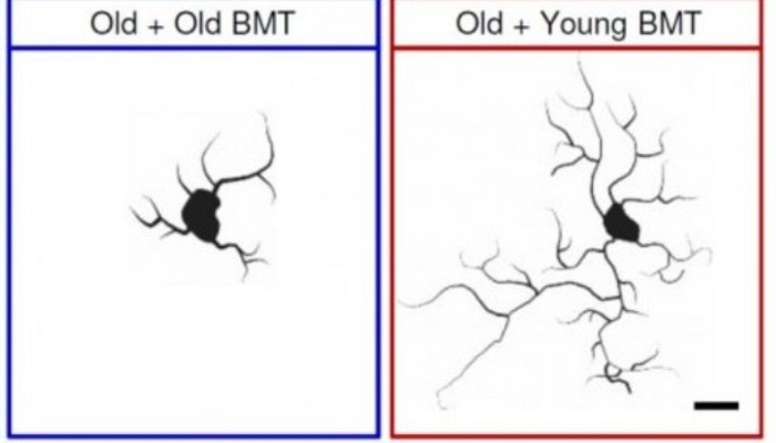 جوان شدن مغز با تزریق مغز استخوان جوان
