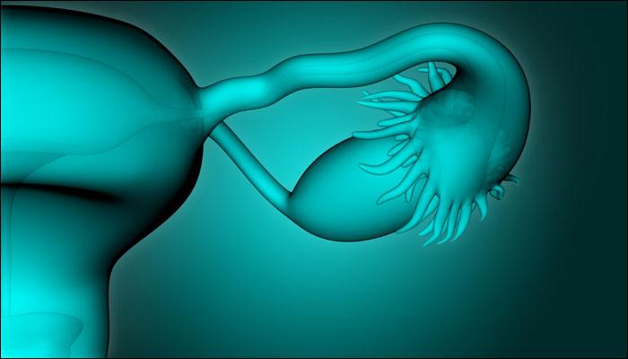 دیابت زنان مبتلا به تخمدان پلی کیستیک را تهدید می کند