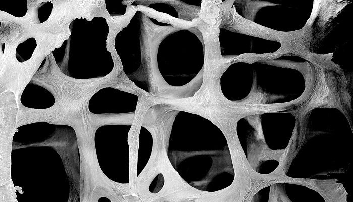 کشف سرنخ های جدید در درمان پوکی استخوان