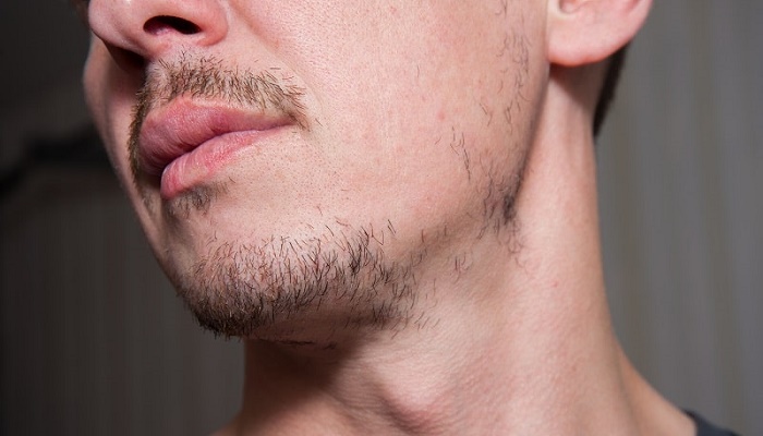 چرا بعضی از مردان ریش ندارند؟
