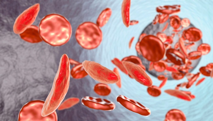 14 سوالی که درباره کم خونی می پرسند