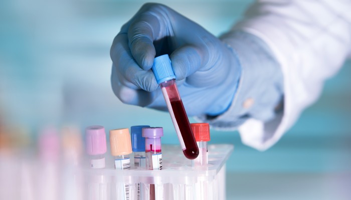 تشخیص سریع و آسان سلیاک با آزمایش خون
