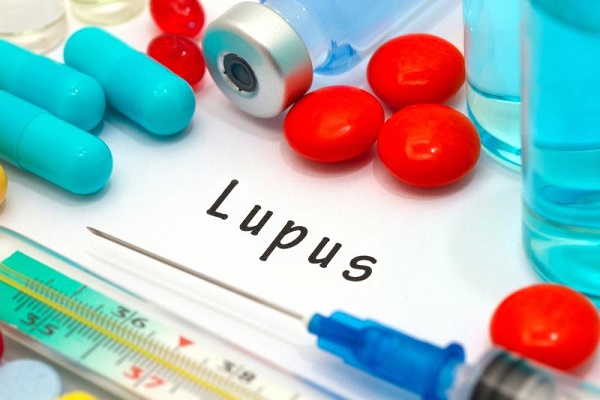 مروری بر تازه های درمان لوپوس
