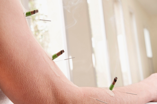 آیا طب سوزنی بی خطر است؟