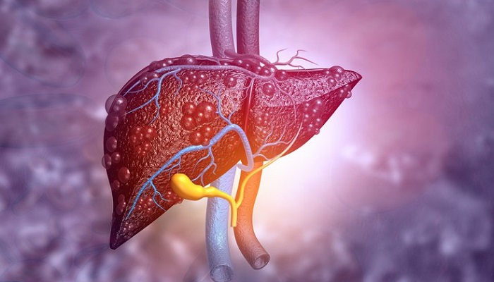 هپاتیت چیست و چگونه منتقل می شود؟ هپاتیت چیست و چگونه منتقل می شود؟