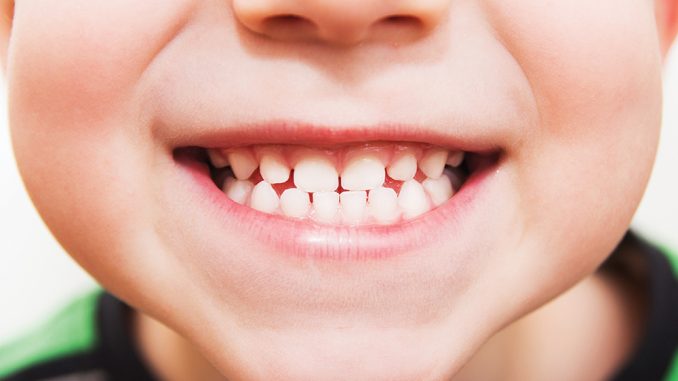 آیا استفاده از فلوراید بی خطر است؟ آیا استفاده از فلوراید بی خطر است؟