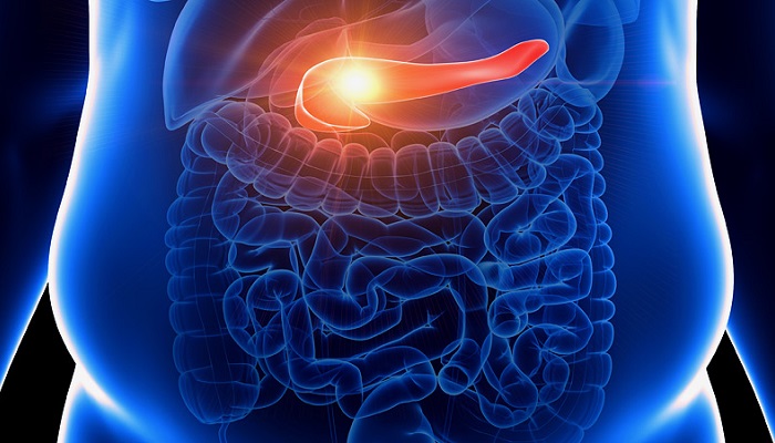 چاقی عامل افزایش نرخ سرطان پانکراس در جهان