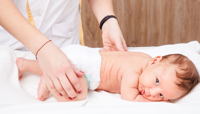علایم در رفتگی مادرزادی لگن نوزاد چیست و چگونه درمان می شود؟