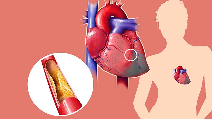 حقایقی حیرت انگیز درباره کلسترول