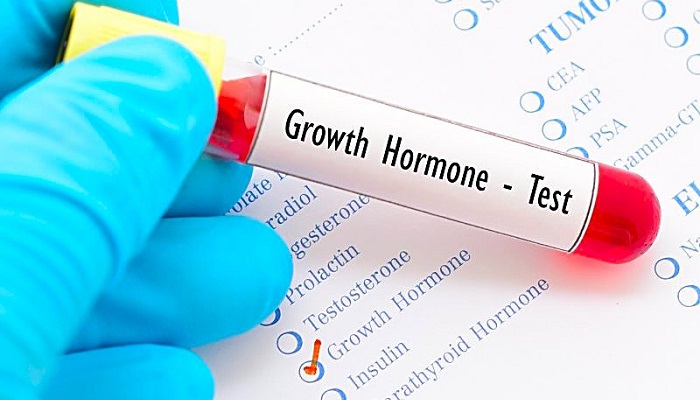 آزمایش اندازه گیری هورمون رشد