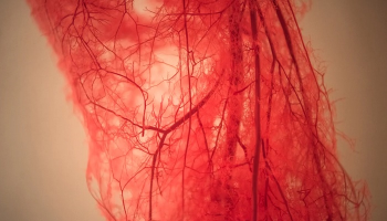 ونوگرافی چیست؟