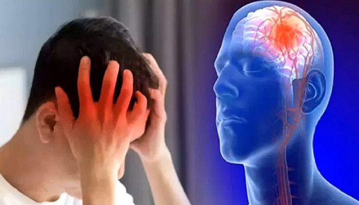 علایم هشدار سکته مغزی را بشناسید علایم هشدار سکته مغزی را بشناسید
