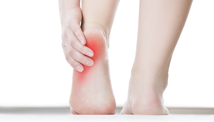 چرا پاشنه پایم درد می کند؟ آیا لازم است به پزشک مراجعه کنم؟