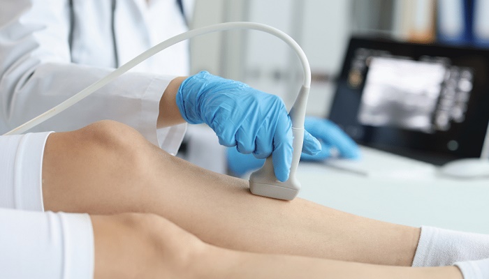 سونوگرافی داپلر چیست؟