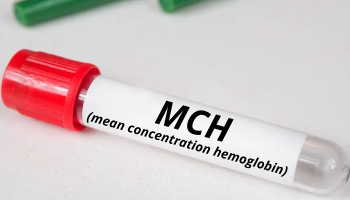 آشنایی با مفهوم MCH در آزمایش خون