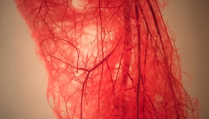 ونوگرافی چیست؟