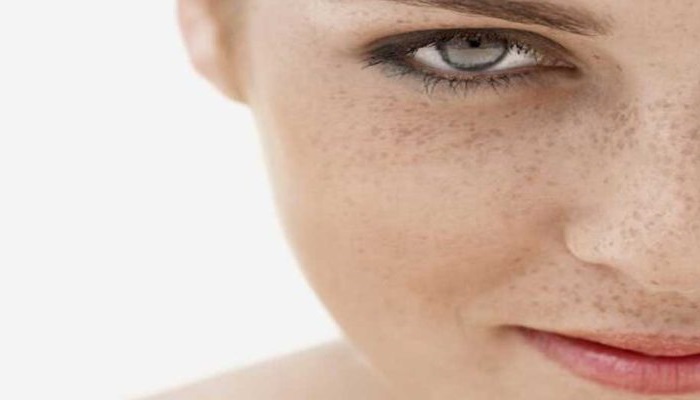 اثر دو جانبه قرص های ضد بارداری روی پوست