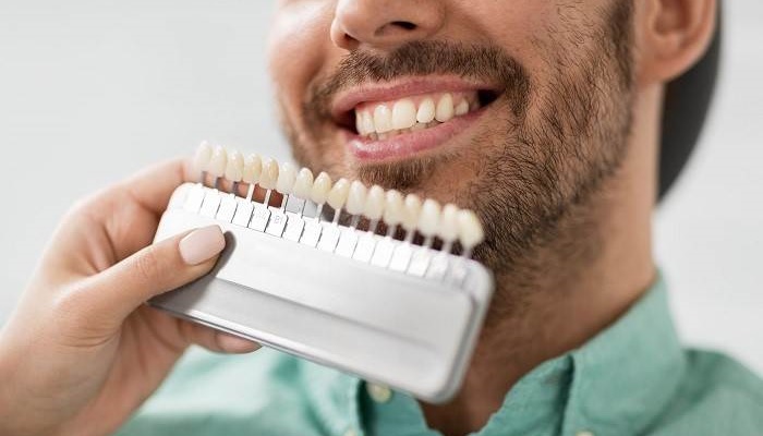 لمینت بهتر است یا کامپوزیت؟ لمینت بهتر است یا کامپوزیت؟