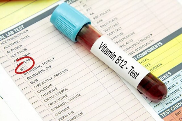 نشانه‌های کمبود ویتامین B12 در صورت ظاهر می‌شود