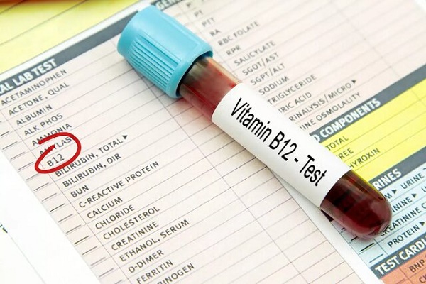 نشانههای کمبود ویتامین B12 در صورت ظاهر میشود نشانههای کمبود ویتامین B12 در صورت ظاهر میشود
