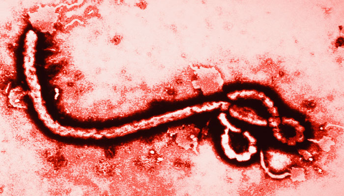آشنایی با بیماری تب خونریزی دهنده ابولا، علایم و روش های درمان