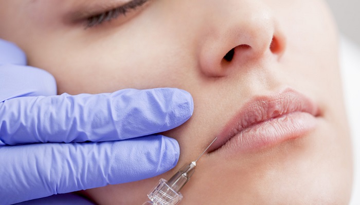 هر آنچه باید درباره تزریق ژل به لب بدانید هر آنچه باید درباره تزریق ژل به لب بدانید