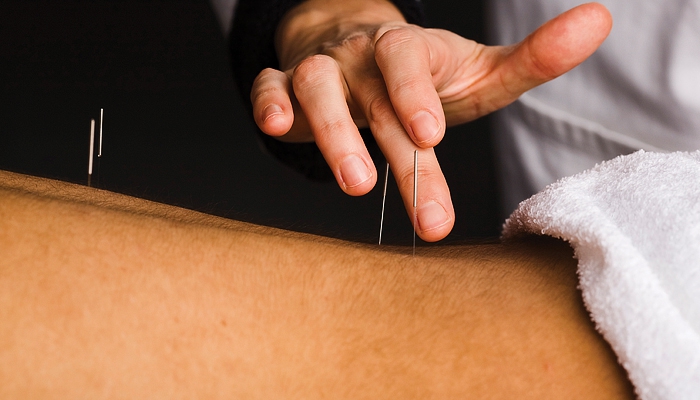 طب سوزنی، معلق میان بلوف و واقعیت طب سوزنی، معلق میان بلوف و واقعیت