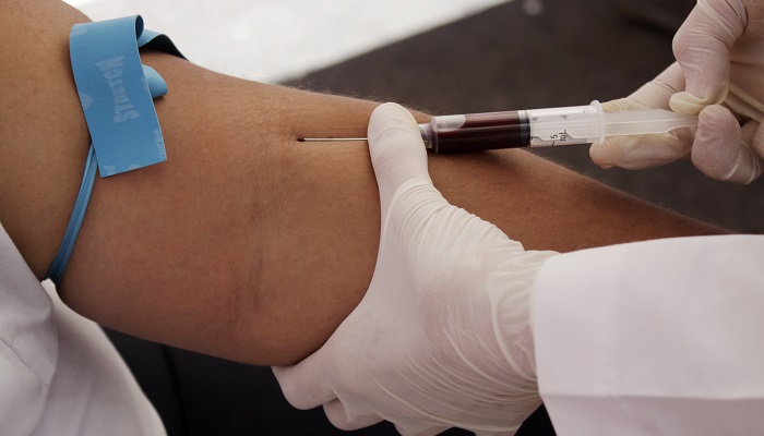 آزمایشات خون برای تشخیص سرطان