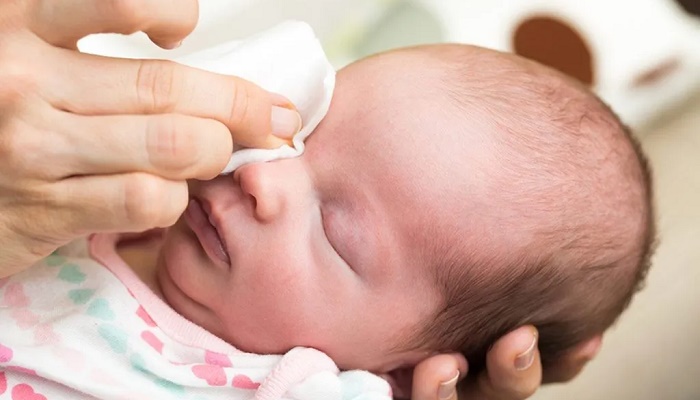 علل عفونت چشم در نوزادان