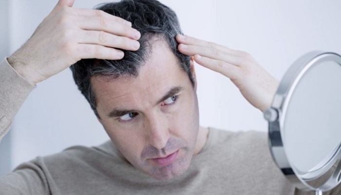 دلیل ریزش مو در مبتلایان به کرونا چیست؟ آیا درمان می شود؟