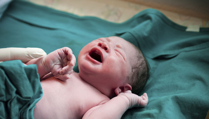 خطر بالای شکستگی لگن در نوزادان متولد شده با وزن کم