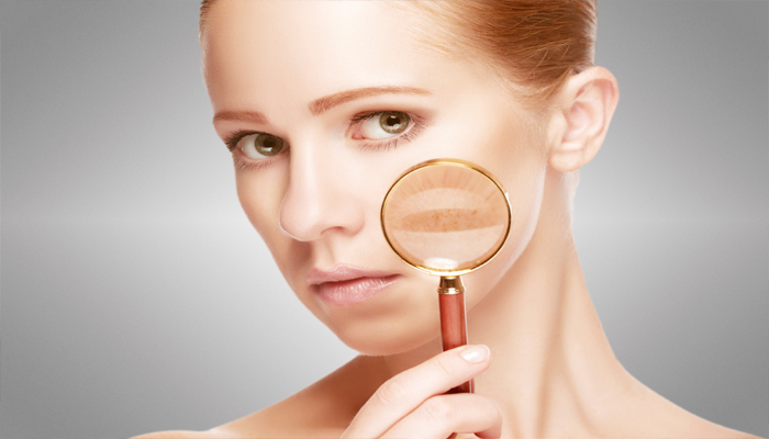 با حساسیت پوستی در بهار چگونه برخورد کنیم؟ با حساسیت پوستی در بهار چگونه برخورد کنیم؟