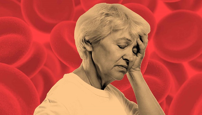 کم خونی چیست و چه علایمی دارد؟ کم خونی چیست و چه علایمی دارد؟