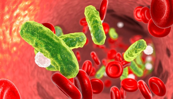 عفونت سپسیس چیست؟