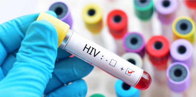 علاج دومین نفر در جهان از ویروس ایدز بدون مداخله پزشکی
