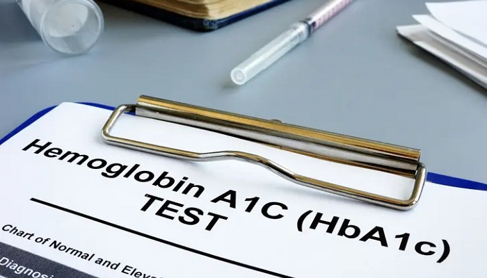 آزمایش A1c چیست و چرا اهمیت دارد؟ آزمایش A1c چیست و چرا اهمیت دارد؟