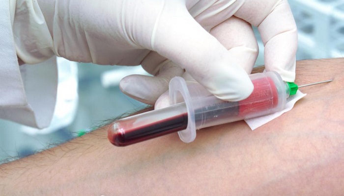 عواملی که روی نتایج آزمایش خون تاثیر می گذارند