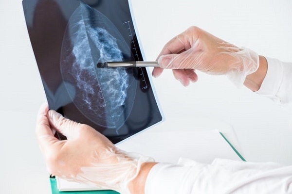 ماموگرافی احتمال بیماری های قلبی را نیز مشخص می کند