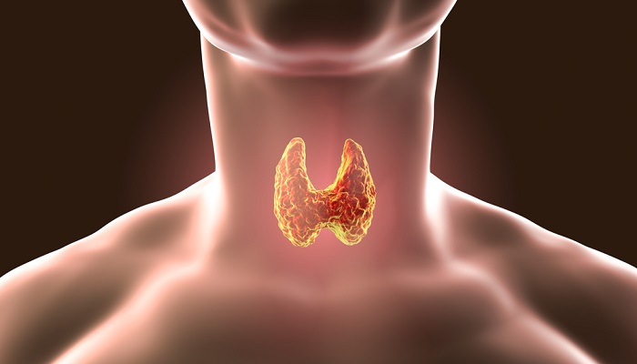 خطرات احتمالی ناشی از عمل جراحی برداشتن غده تیرویید خطرات احتمالی ناشی از عمل جراحی برداشتن غده تیرویید